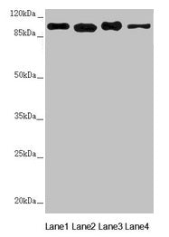 DHTKD1 Antibody