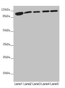 DHTKD1 Antibody