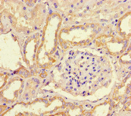 WNK4 Antibody