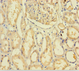C9orf72 Antibody