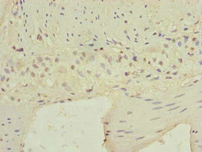 CARD19 Antibody