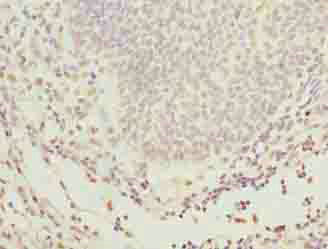 GLT1D1 Antibody