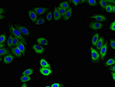 ZDHHC15 Antibody