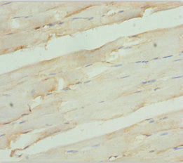 RDH12 Antibody