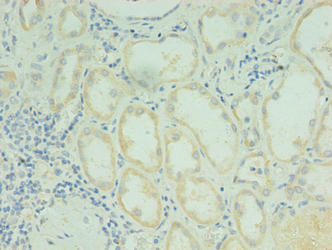 RDH12 Antibody