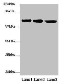 CATSPER2 Antibody