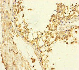 XPO6 Antibody