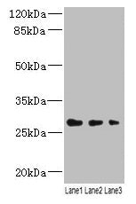 LRRC57 Antibody