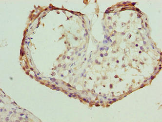 FSIP1 Antibody