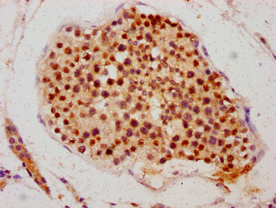 ATG16L2 Antibody