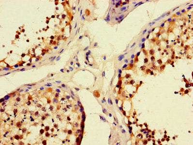 UNC13C Antibody