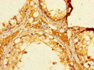 FBXO15 Antibody