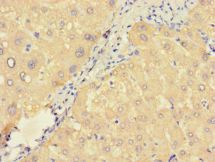 ZNF738 Antibody