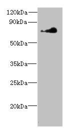 NEK11 Antibody