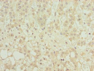 MFSD8 Antibody