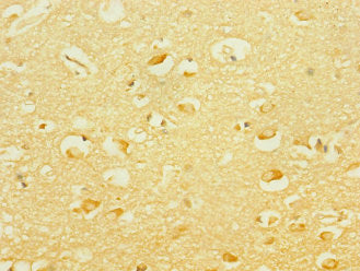 PCDH19 Antibody