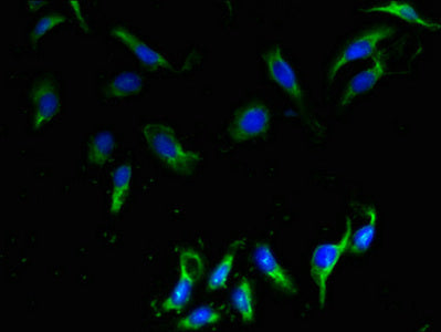 CMTM2 Antibody