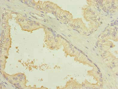 SLC7A14 Antibody
