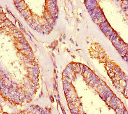 SHROOM3 Antibody