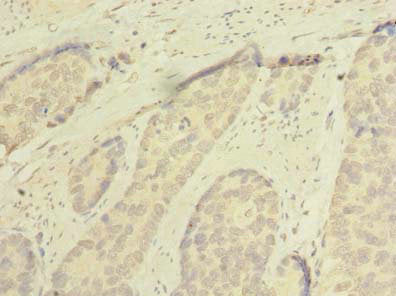 SSMEM1 Antibody