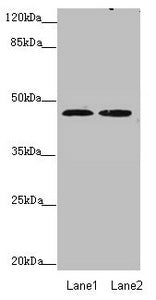 ZDHHC16 Antibody