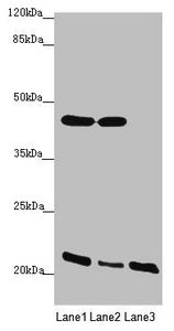 ZDHHC16 Antibody