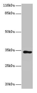 KIAA1191 Antibody