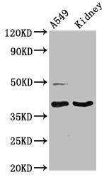 LGALS12 Antibody