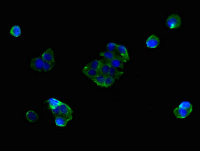 SLC25A38 Antibody