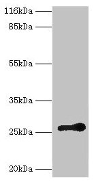 RAB3C Antibody
