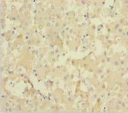 NEIL1 Antibody