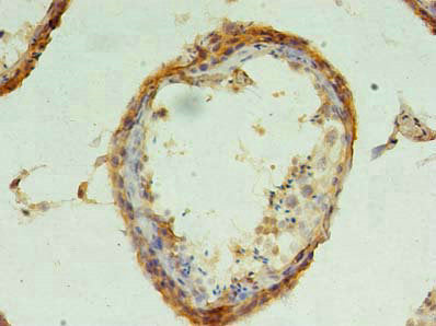 CHMP6 Antibody