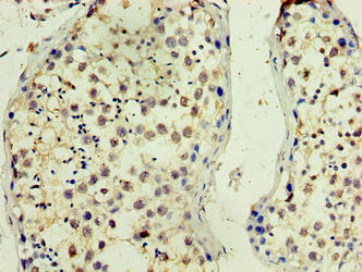 TMX3 Antibody