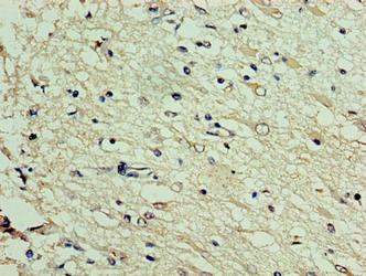 DNAJC30 Antibody