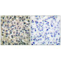 JUP Antibody