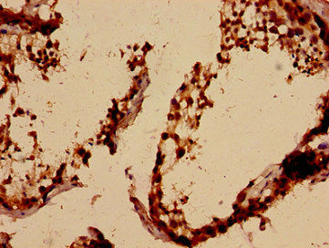 ALKBH3 Antibody