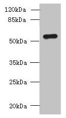 SLC38A2 Antibody
