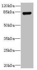 TGS1 Antibody