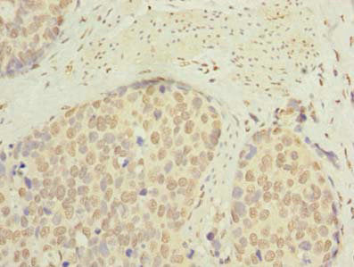 SLC22A18AS Antibody