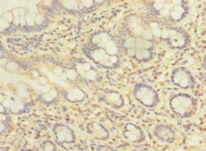 ZFAND2A Antibody