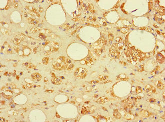 SAMD12 Antibody