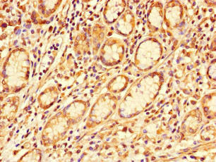 GALNT11 Antibody