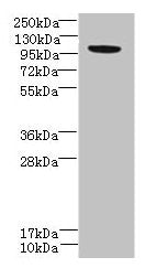 PPFIBP2 Antibody