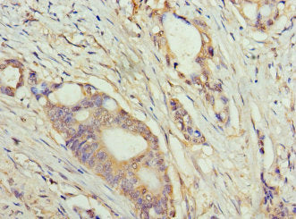 TET1 Antibody