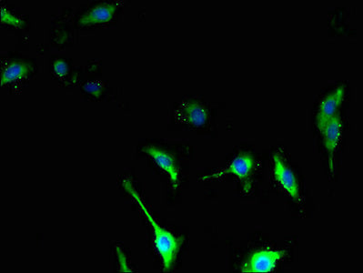 TSPAN14 Antibody