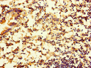 RTN4IP1 Antibody