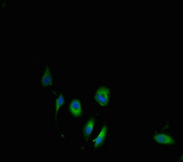 Cbs Antibody