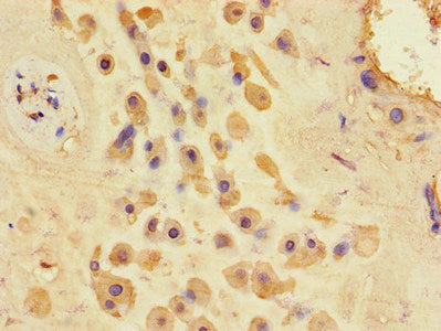 TSC1 Antibody