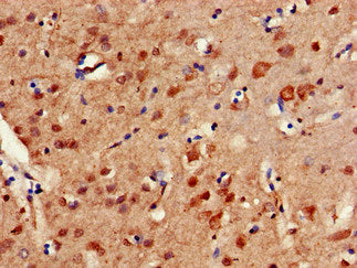 ERCC4 Antibody