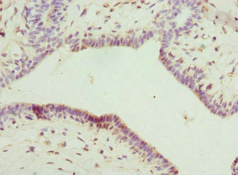 IL22RA2 Antibody